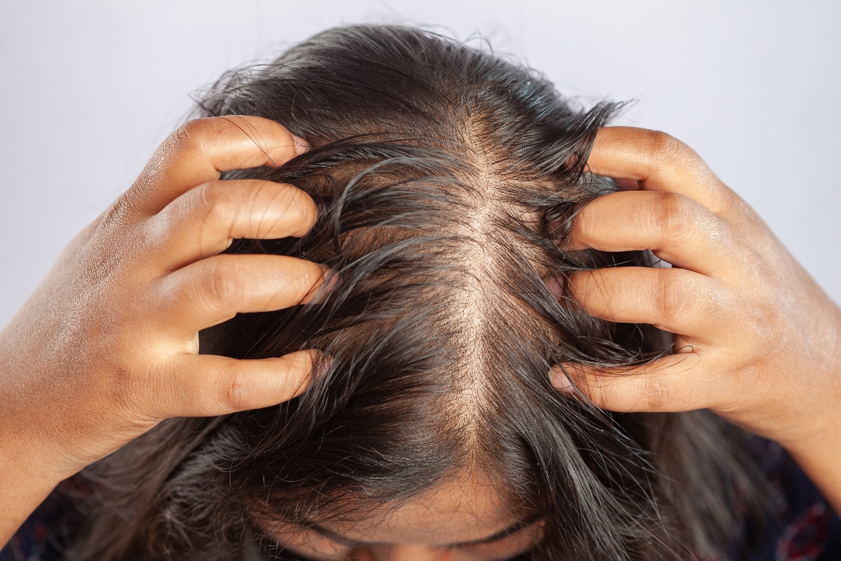 ¡No más alopecia! 5 remedios caseros para la caída del cabello