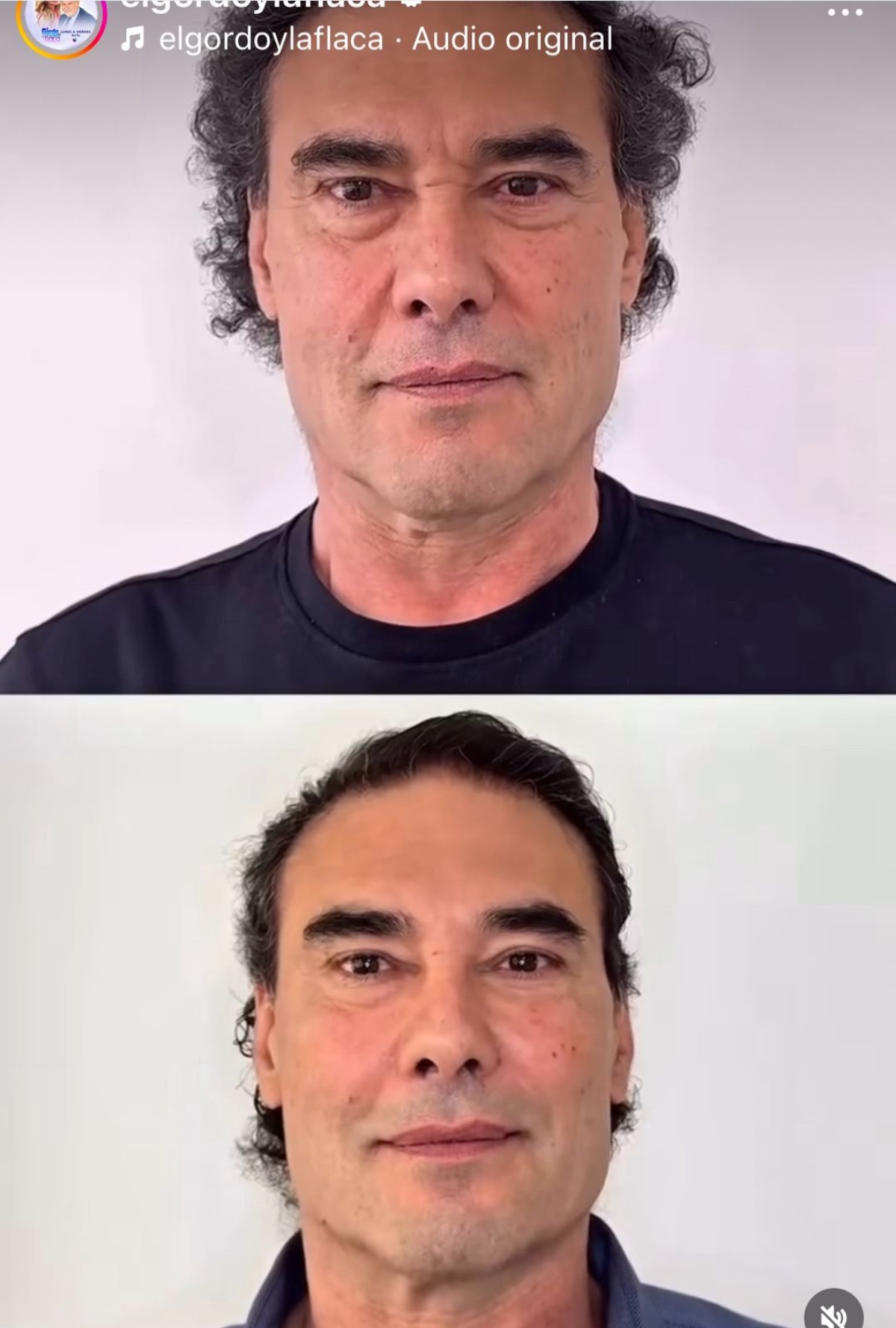 cirugía, tratamiento, facial