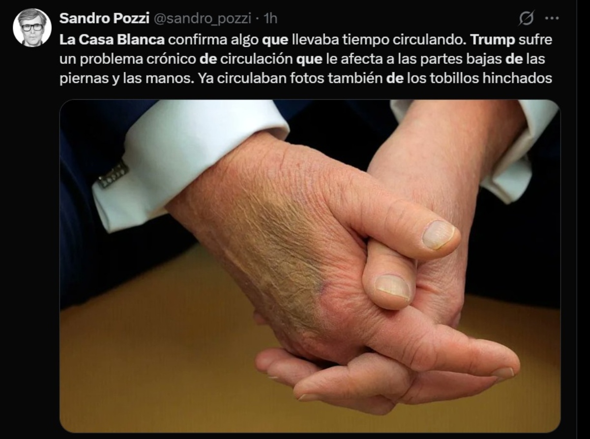 Donald Trump salud