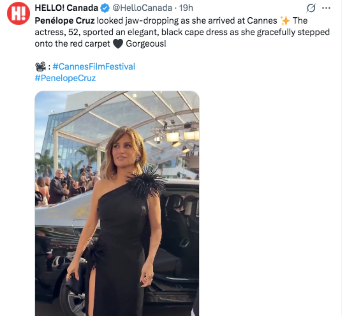 Penélope Cruz y su supuesto aneurisma cerebral