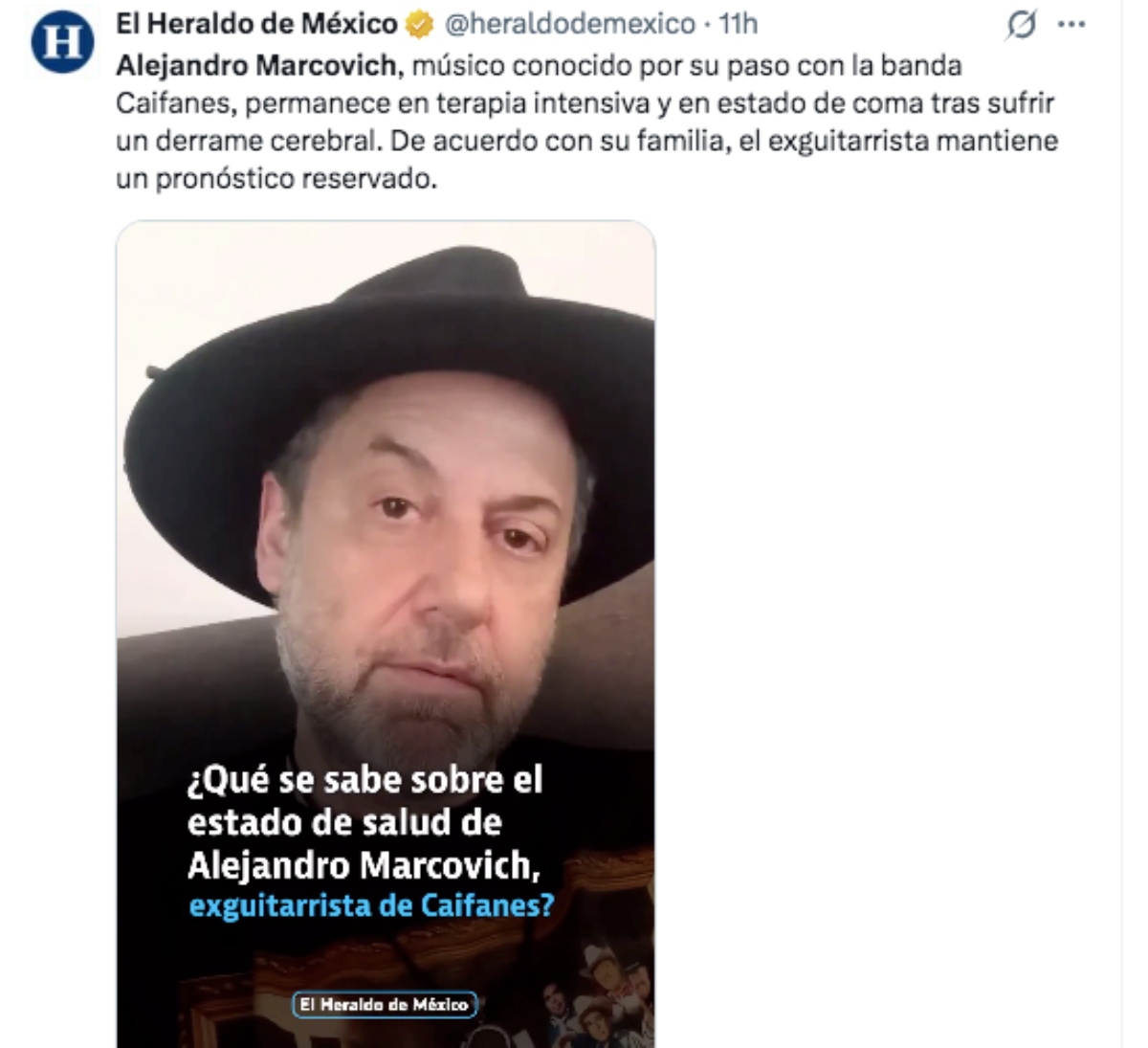 Alejandro Marcovich, exguitarrista de Caifanes está en coma