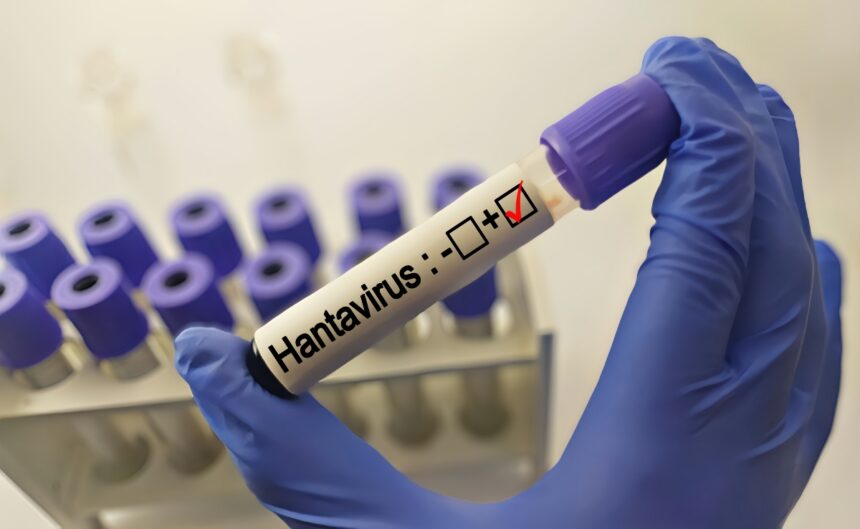 Hantavirus in the United States, Hantavirus, epidemic, United States, QuéOnnda