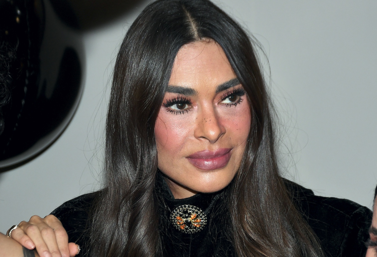 Galilea Montijo es duramente criticada por su rostro con cirugías